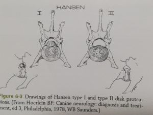 hansen i-ii