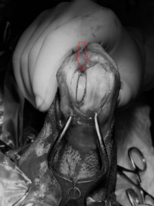 patella fekete