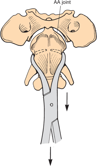 ventral