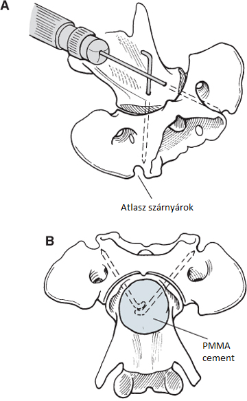 ventral2