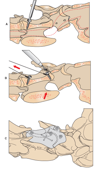 ventral3