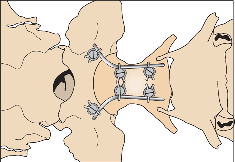 ventral4